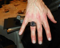 Dan Hoard's ring. Dan-Hoards-ring